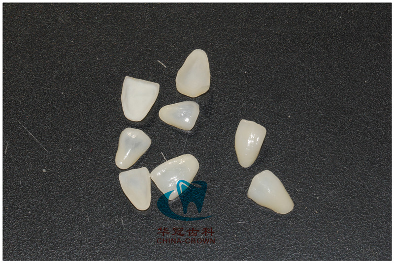DSMR超晶瓷贴面